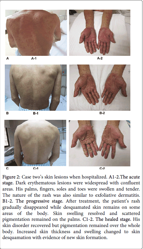 occupational-medicine-health-affairs-skin-lesions