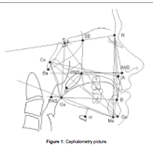 oral-hygiene-and-health-Cephalometry-picture