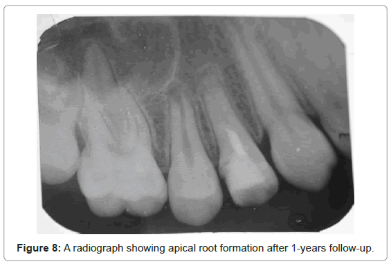 oral-hygiene-health-a-radiograph-formation