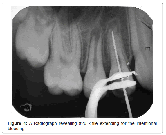 oral-hygiene-health-a-radiograph-intentional