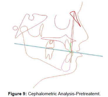 oral-hygiene-health-cephalometric-analysis