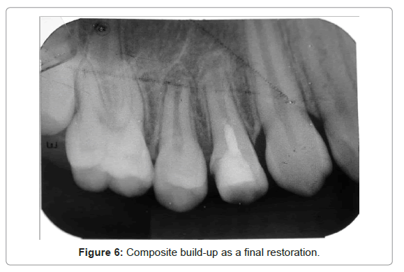 oral-hygiene-health-composite-build-up-final