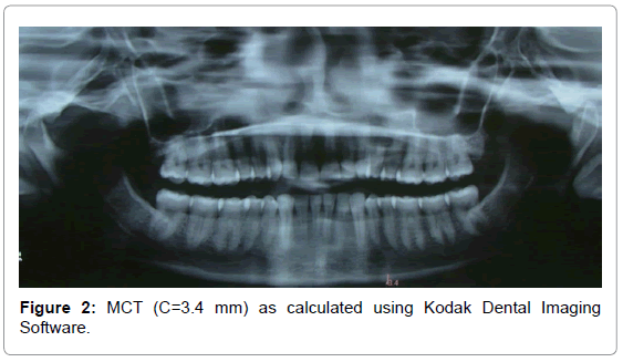 Kodak Dental Imaging Software Installation 6.1