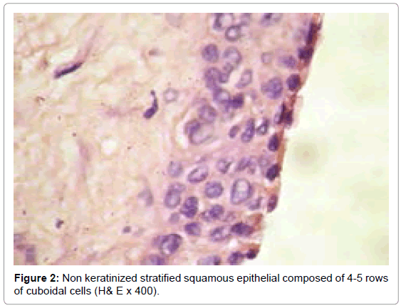 oral-hygiene-health-non-keratinized-stratified