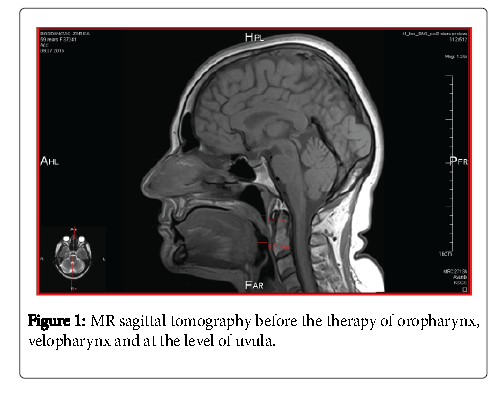 oral-hygiene-health-oropharynx