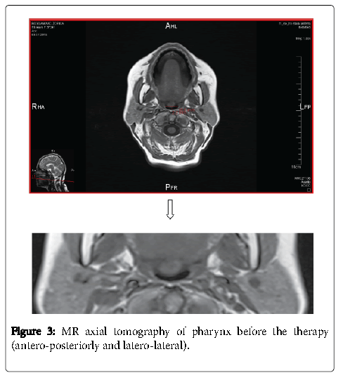 oral-hygiene-health-pharynx