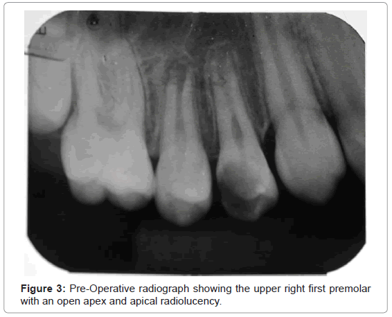 oral-hygiene-health-pre-operative-radiograph