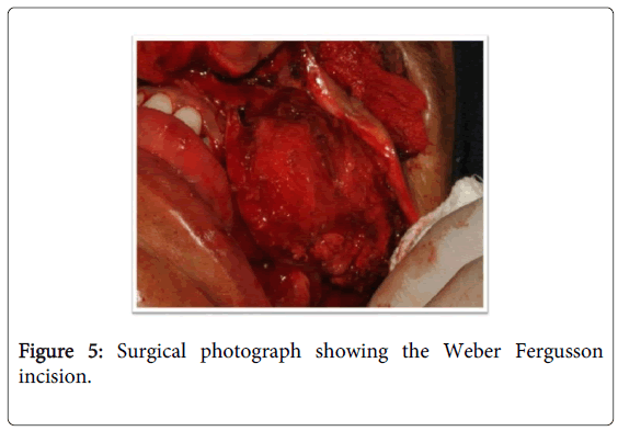 oral-hygiene-health-surgical-photograph