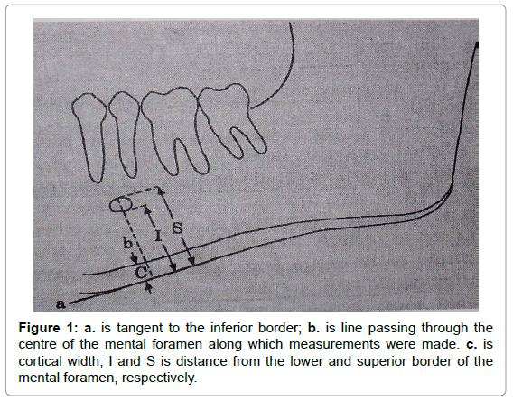 oral-hygiene-health-tangent-inferior-border