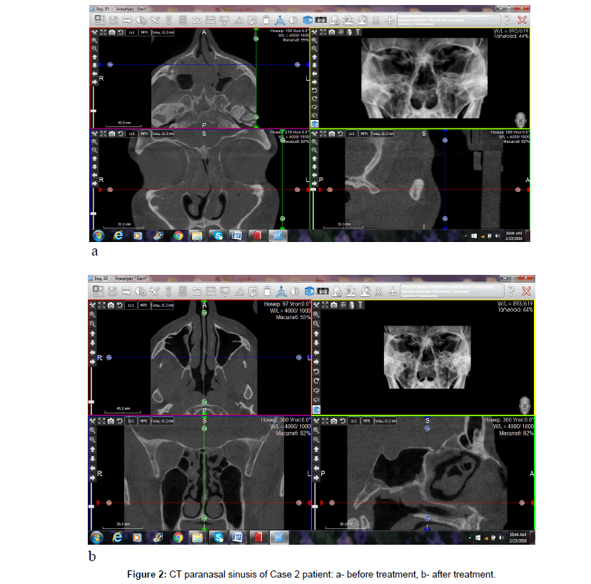 orthopedic-oncology-before-treatment