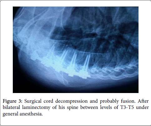 orthopedic-oncology-general-anesthesia