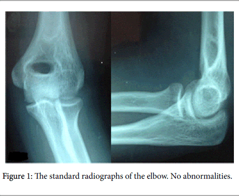 orthopedic-oncology-standard-radiographs