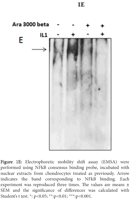 osteoarthritis-Electrophoretic-mobility-shift-assay