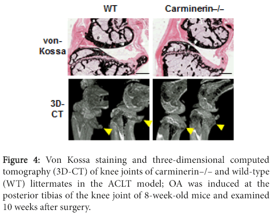 osteoarthritis-Von-Kossa-staining-three-dimensional