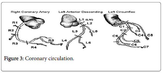 pain-relief-Coronary-circulation