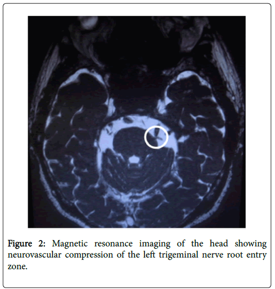 pain-relief-Magnetic-resonance-imaging