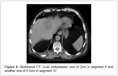 palliative-care-medicine-Abdominal-CT