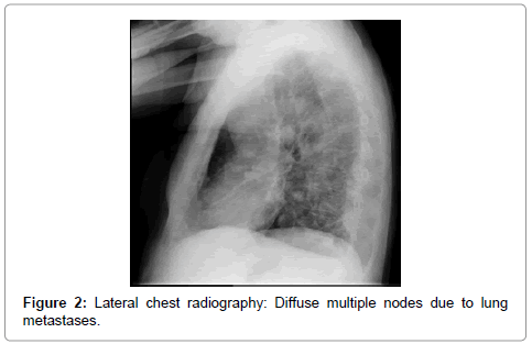 palliative-care-medicine-chest-radiography