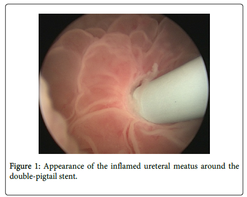 palliative-care-medicine-inflamed-ureteral-meatus