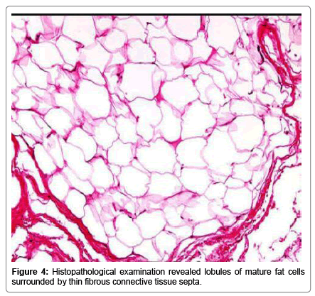 pediatric-dental-care-Histopathological-examination