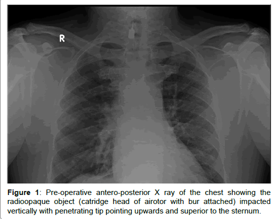 pediatric-dental-care-Pre-operative-antero-posterior