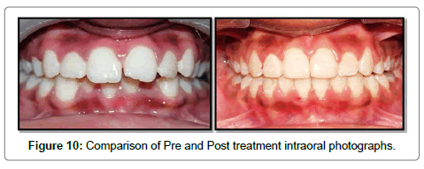 pediatric-dental-care-intraoral