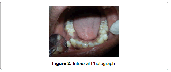 pediatric-dental-care-intraoral