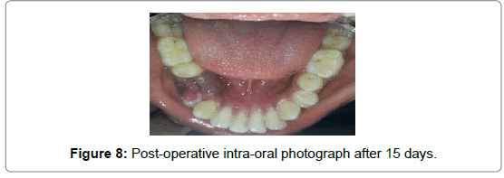 pediatric-dental-care-oral