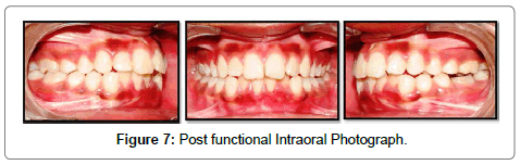 pediatric-dental-care-photograph