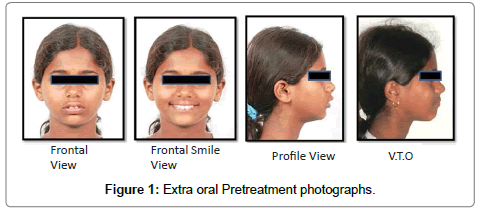 pediatric-dental-care-photographs