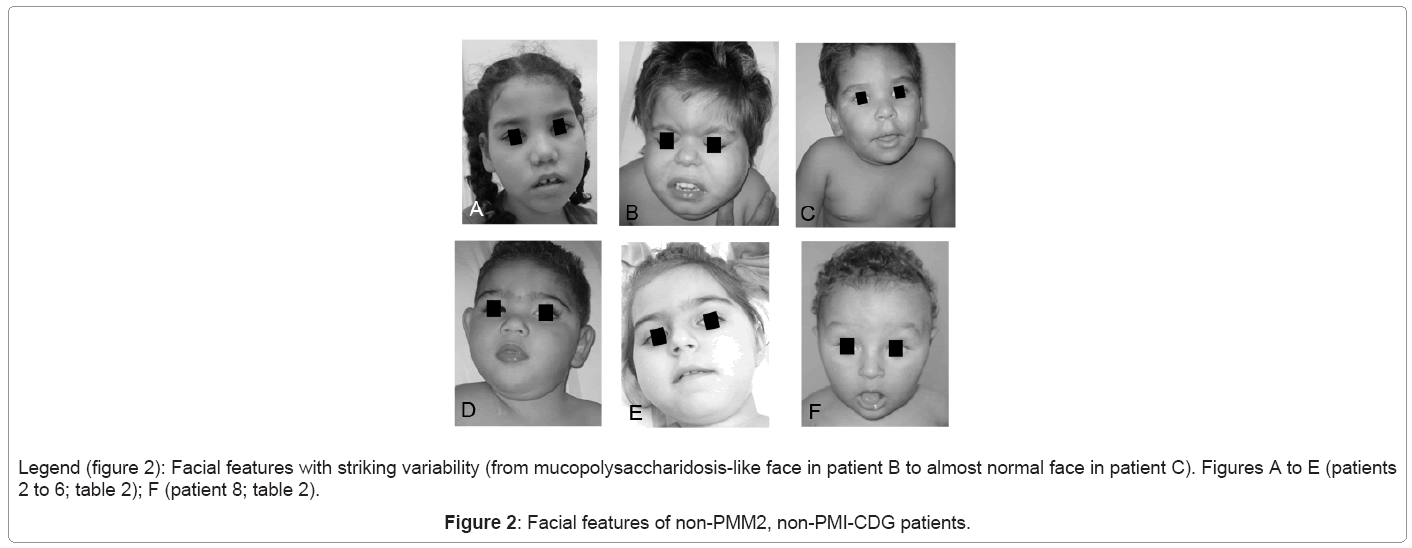 Clinical and Molecular Features of Patients with Congenital Disorders ...