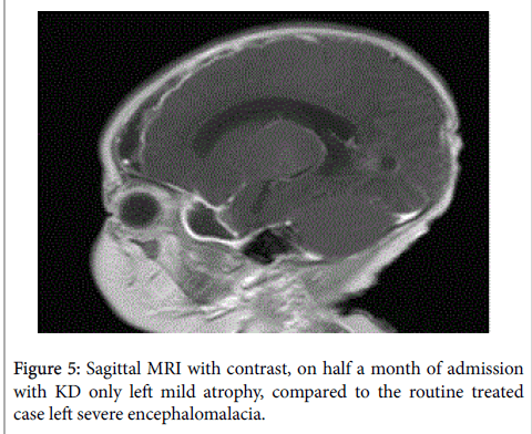 pregnancy-and-child-health-mild-atrophy