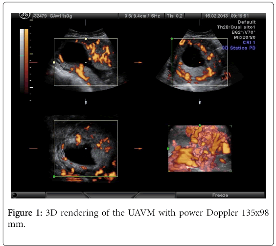 pregnancy-child-health-power-Doppler