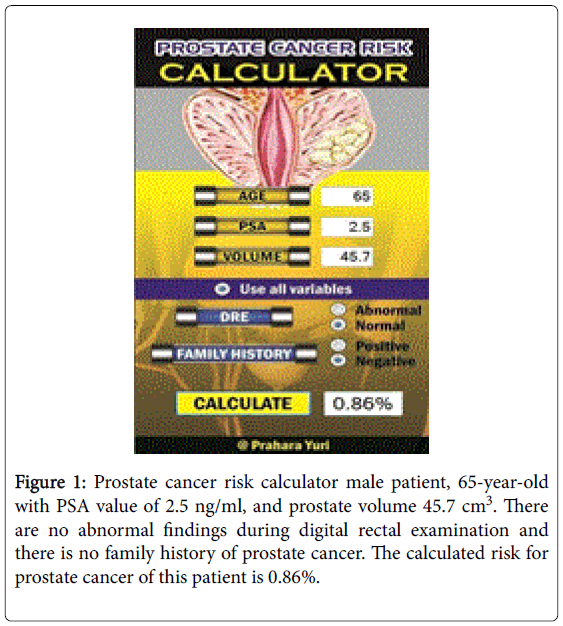 prostate volume calculator