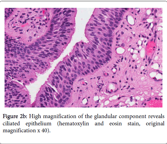 pulmonary-respiratory-medicine-High-magnification