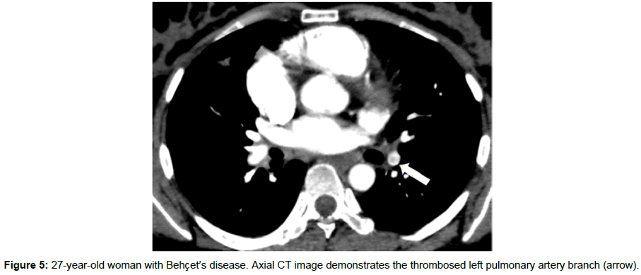 radiology-Axial-CT-image