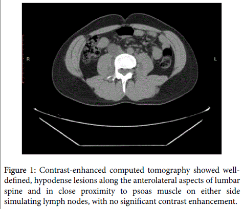 radiology-Contrast-enhanced
