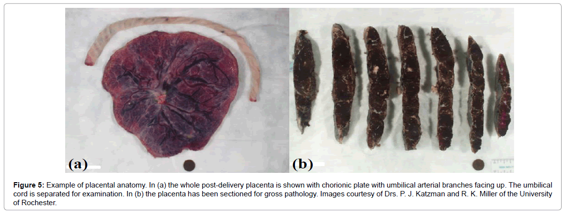 radiology-Example-placental-anatomy