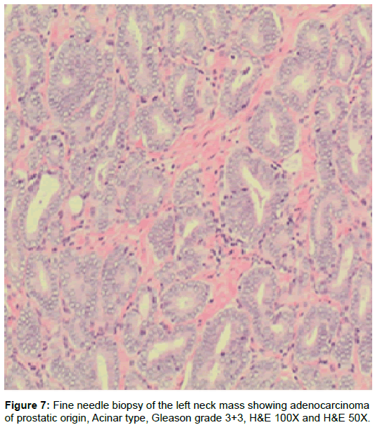 radiology-Fine-needle-biopsy