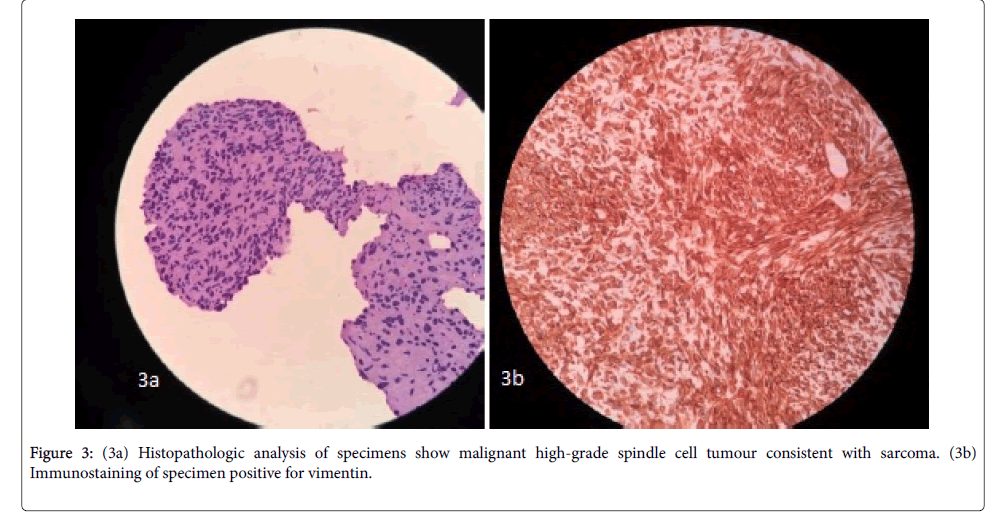 radiology-Histopathologic-analysis