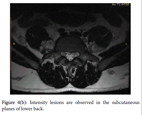 radiology-Intensity-lesions