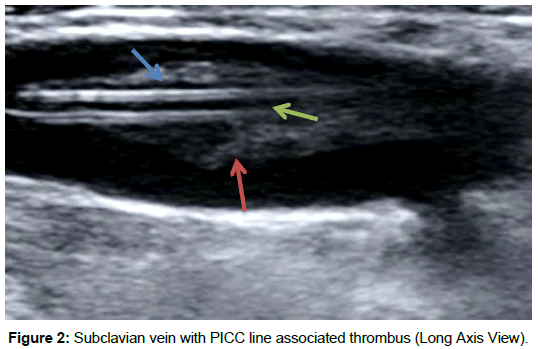 radiology-Long-Axis-View