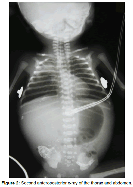 radiology-Second-anteroposterior