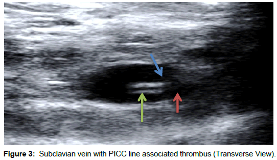 radiology-Transverse-View