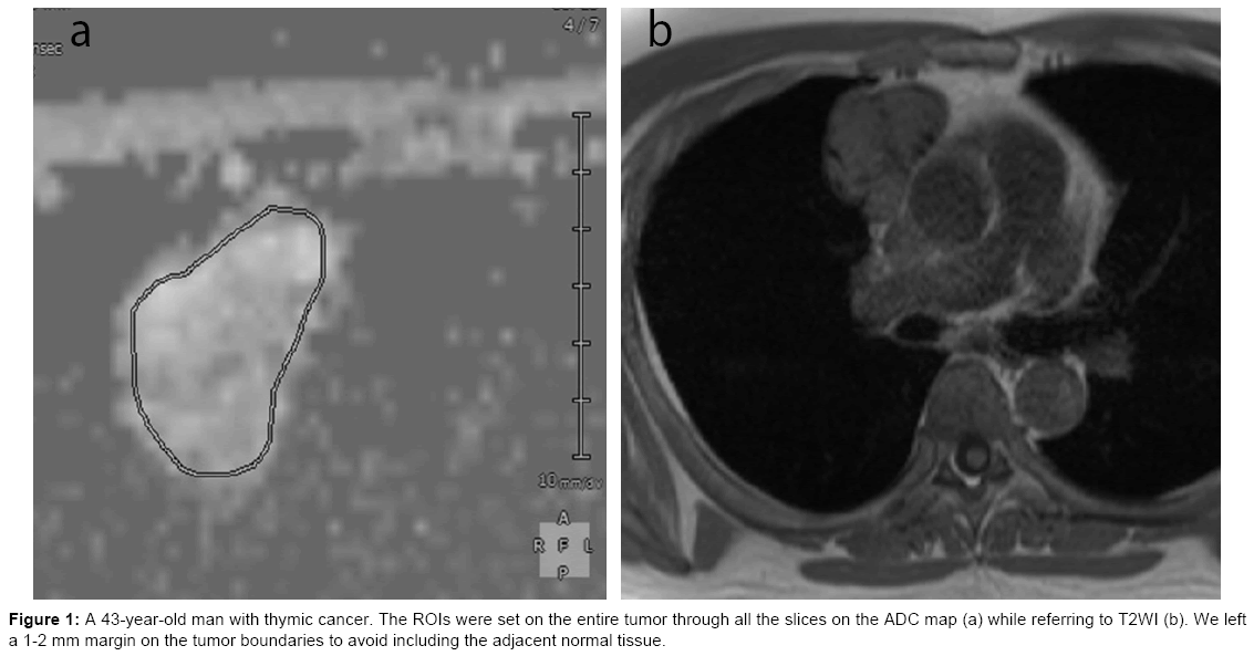 radiology-adjacent-normal-tissue