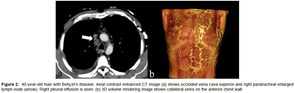 radiology-anterior-chest-wall