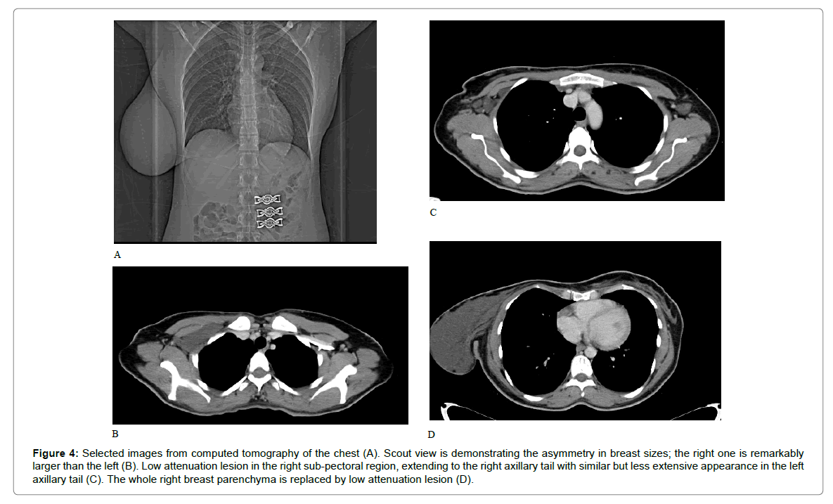 radiology-attenuation-lesion