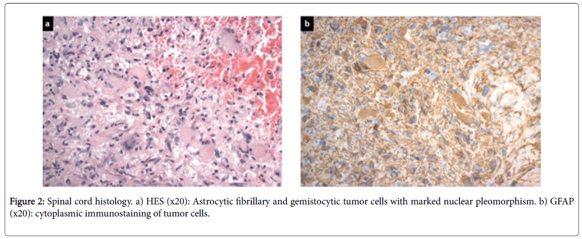 radiology-cord-histology