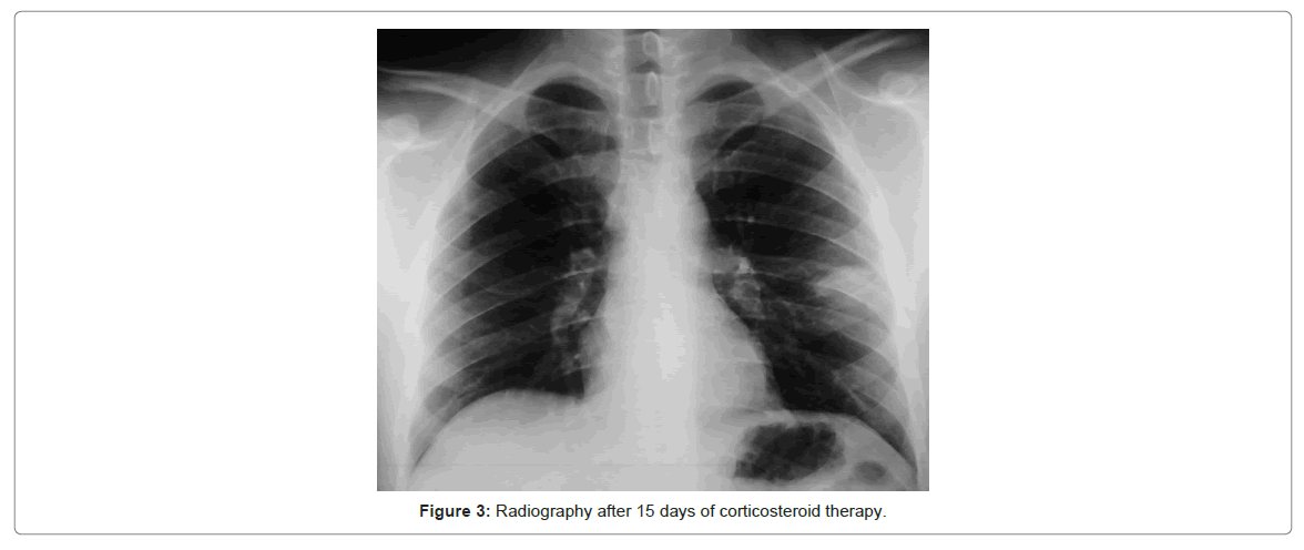 radiology-corticosteroid-therapy