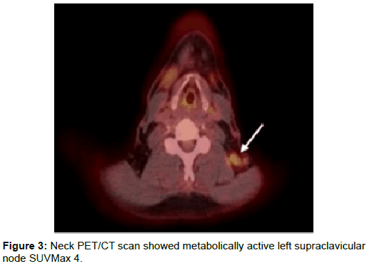 radiology-metabolically-active